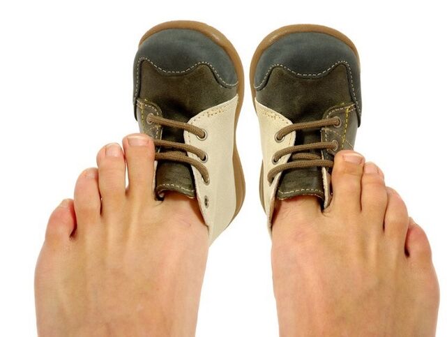 pantofii strânși ca cauză a ciupercilor între degetele de la picioare