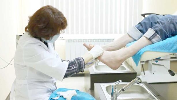 Un dermatolog tratează ciuperca unghiilor de la picioare