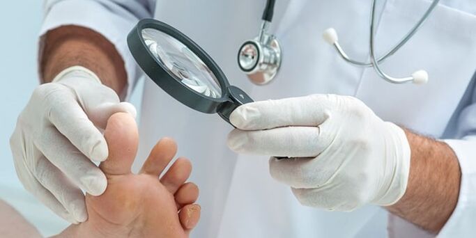 Doctorul a examinat piciorul infectat cu o ciupercă